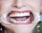 Dental__1697.JPG