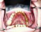 Dental__3499.JPG
