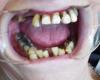 Dental__3953.JPG